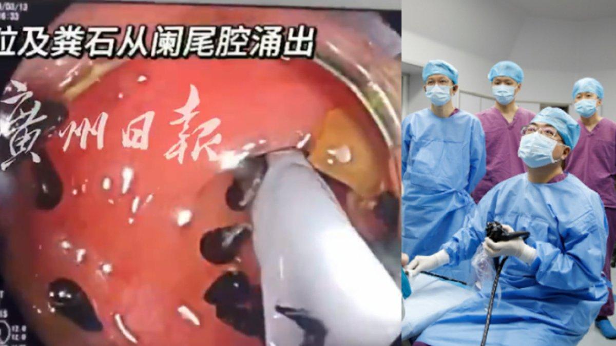 Ilustrasi dokter terkejut menangani pasien nyaris tewas gegara menelan setengah lusin biji semangka