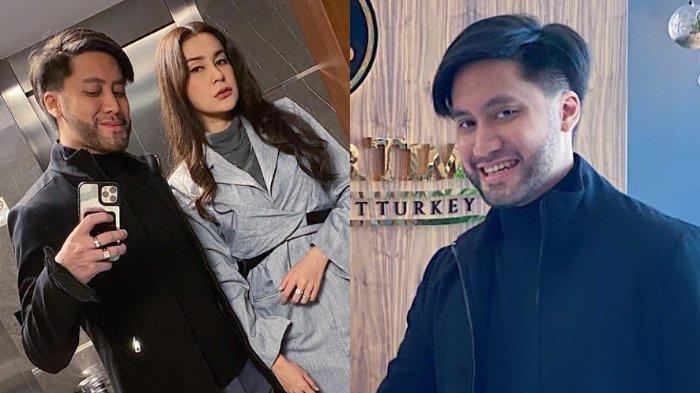 Penampilan terbaru Kevin Aprilio setelah transplantasi rambutnya makin sempurna