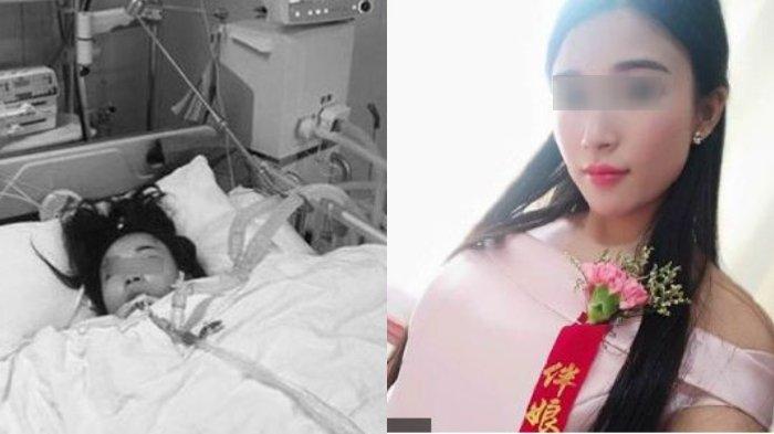 Pengiring pengantin yang betisnya harus diamputasi