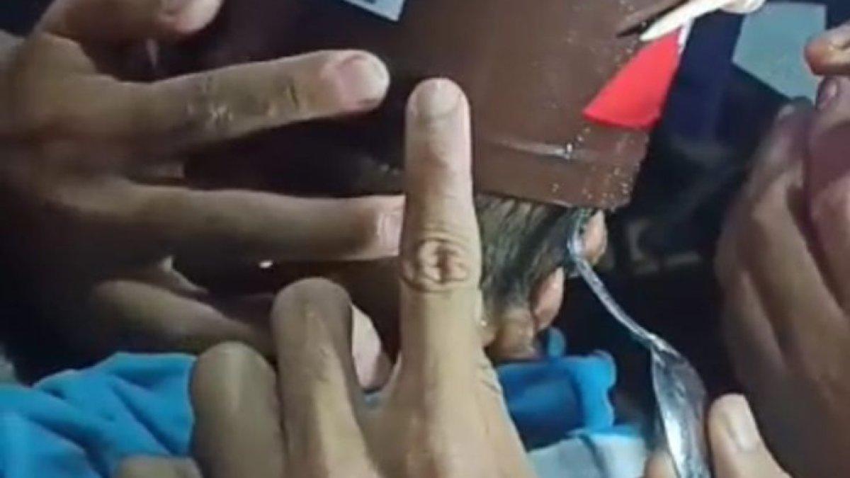 PILU kepala balita tersangkut kaleng bekas