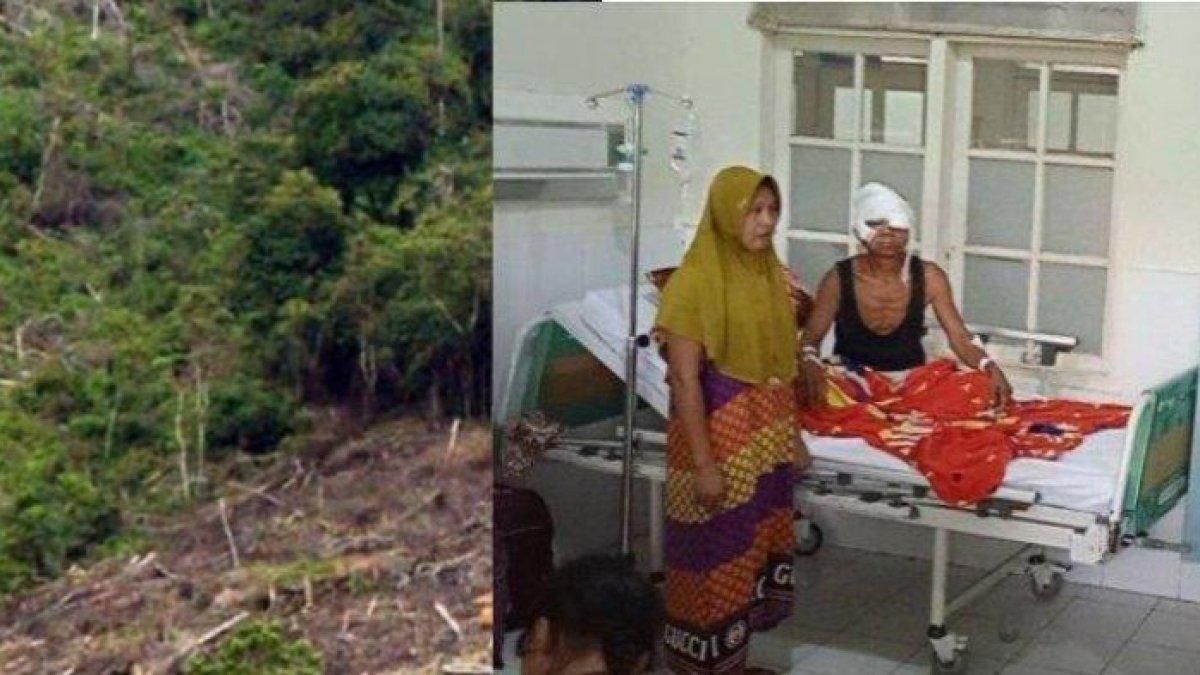 Pria di Jambi mendadak diserang hewan buas di hutan