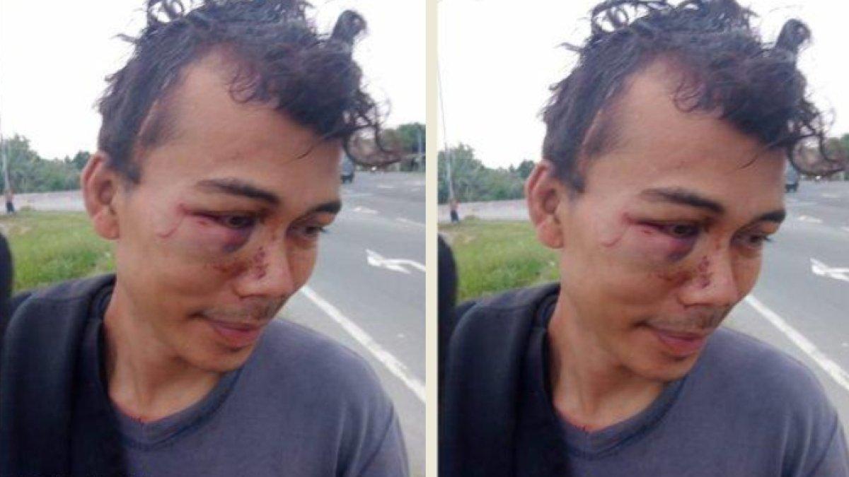 Pria warga Kabupaten Serdang Bedagai dicuri kawanan preman pada Rabu (19/7/2023) malam.
