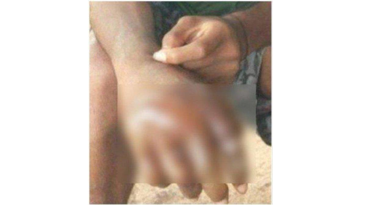 siswa dianiaya oknum guru di Flores Timur