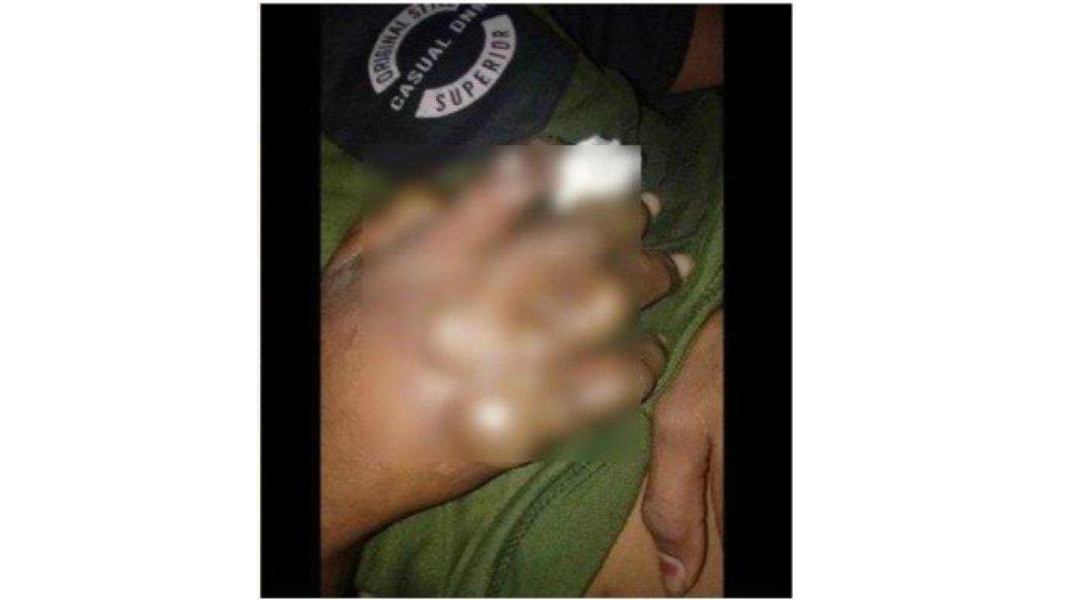 siswa jadi korban disiksa oknum guru di Flores Timur