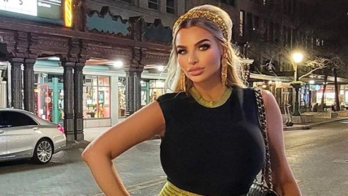 Sosok Katy Ann suka lakukan operasi berkali-kali