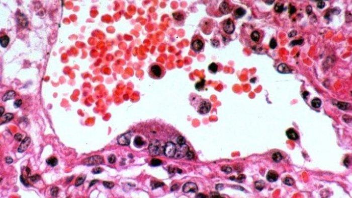 Perhatikan kunci jawaban Ilmu Pengetahuan Alam (IPA) kelas 8 SMP/ MTs