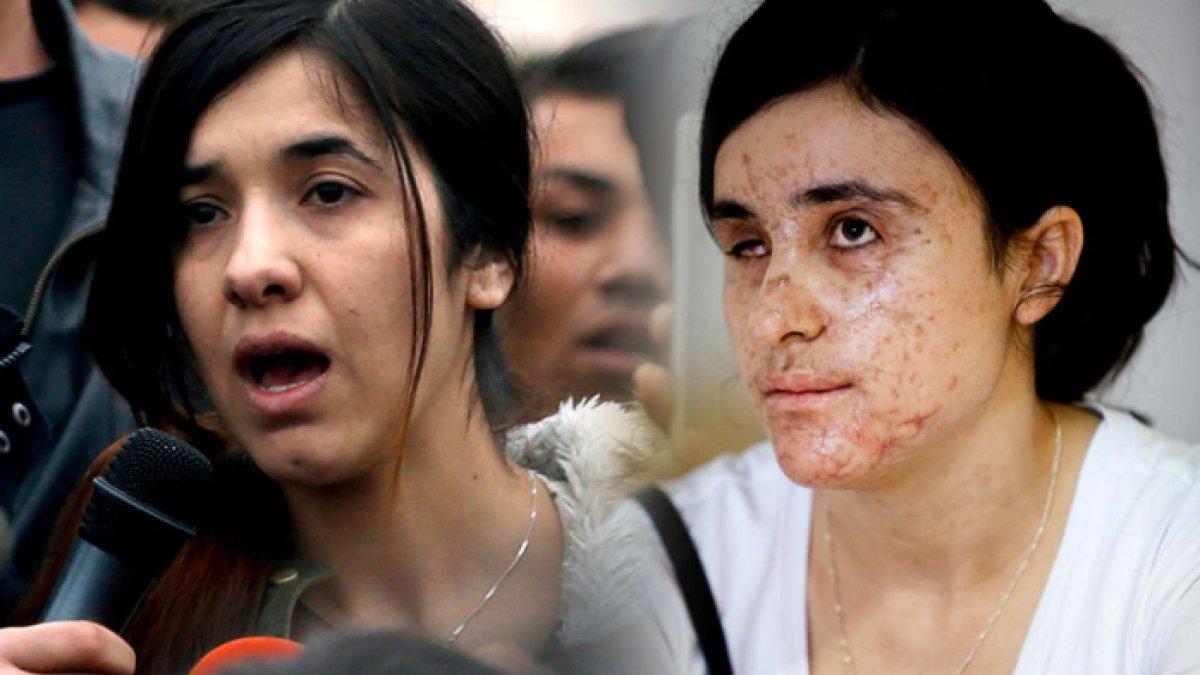 Sosok wanita ini dulu dijadikan budak birahi oleh kelompok radikal, kini sukses jadi duta besar di PBB, gaungkan HAM