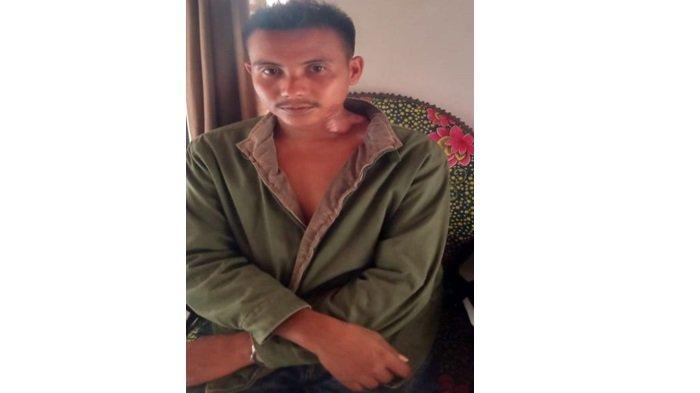 Kondisi Rendi Ketua KPPS di Nagari Gunung Padang Alai, Kecamatan V Koto Timur, Padang Pariaman, Sumatera Barat setelah tertimpa tali listrik
