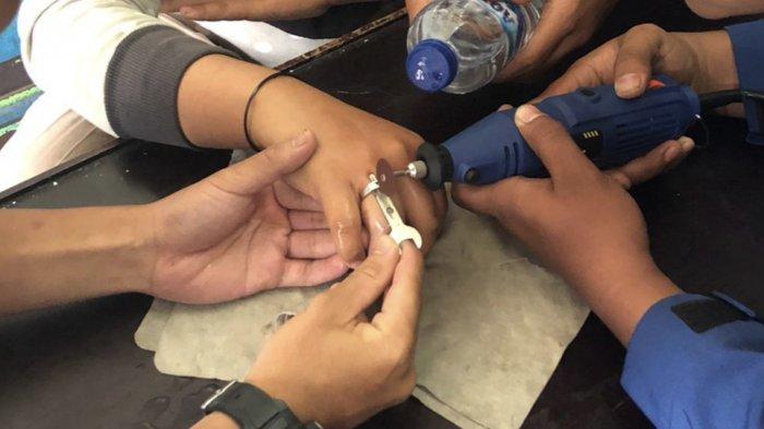 Petugas Damkar melakukan proses pelepasan cincin di jari bengkak