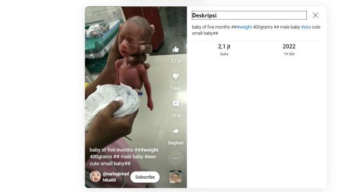 Tangkapan layar video bayi yang dilahirkan dari Adnan (bayi asal Batang Kapas yang viral karena hamil) yang beredar di media sosial. Bayi dalam video merupakan bayi prematur yang lahir di India dan diunggah oleh chanel YouTube  @narlagirirad pada 19 Oktober 2022 dan diunggah ulang pada 22 Juli 2023. Tangkapan layar diambil pada Kamis (26/10/2023).