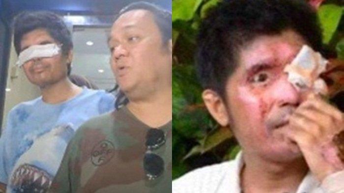 Agus Salim dan Farhat Abbas. Agus Salim Keceplosan, Ciri-ciri Sudah Bisa Melihat Disorot, Farhat Abbas Salah Tingkah