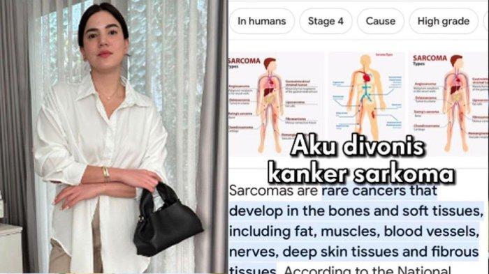 Alice Norin divonis kanker sarkoma