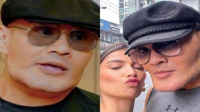Deddy Corbuzier Mengaku Suntik Stem Cell Usai Perubahan Dagunya Disorot, Apa Itu?