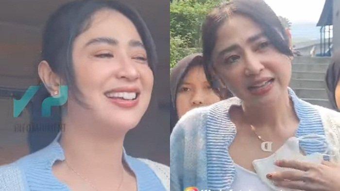 Dewi Perssik membantah dirinya memasang susuk di jidat.