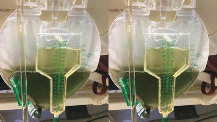 Air Rumah Tiba-Tiba Berwarna Kuning? Ini Penyebabnya!