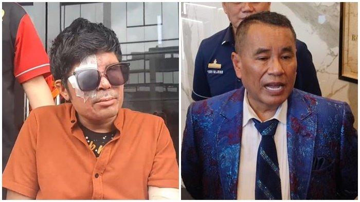 Agus Salim, korban penyiraman air keras (kiri) Hotman Paris (kanan). - Hotman Paris kuliti permintaan maaf Agus Salim.
