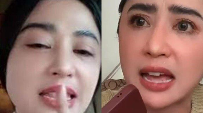 Imbas Emosi Dewi Perssik Bereaksi Tubuhnya Disebut Sarang Jin