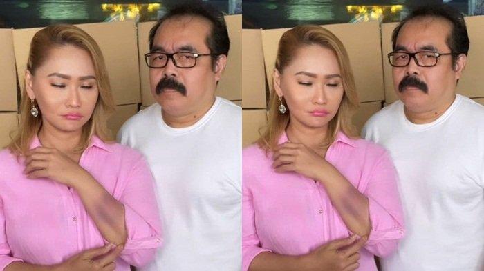 Inul Daratista murka Adam Suseno disebut numpang hidup, singgung harga diri suami.
