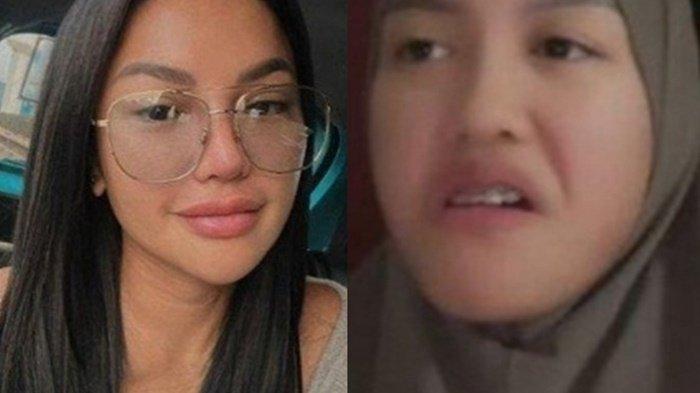 (Kiri) Nikita Mirzani (Kanan) Lolly - Kasus Lolly Aborsi Makin Panjang, Dokter yang USG Anak Nikita Mirzani Diperiksa