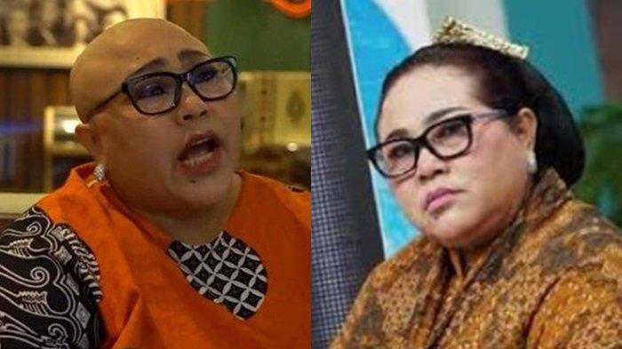 Kondisi Baru Nunung Pasca Kemoterapi, Kepalanya Botak