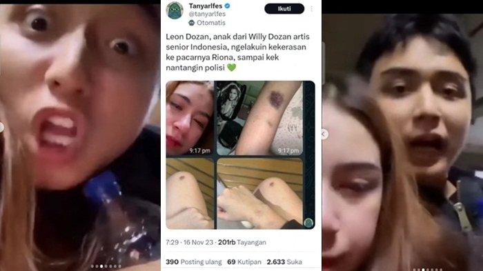 Leon Dozan diduga aniaya pacarnya.