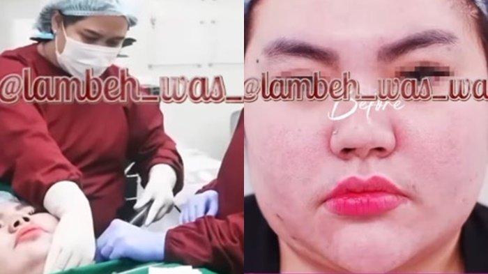 PENAMPILAN LISA MARIANA - Tangkapan layar Instagram Lambe Was Was Selasa (15/4/2025). Lisa Mariana melakukan sedot lemak untuk merubah bentuk tubuhnya