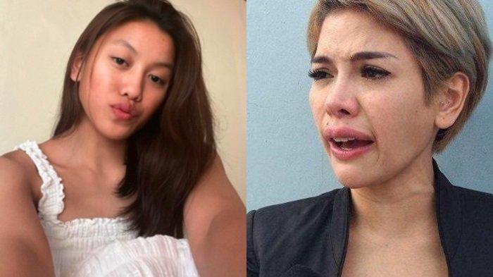 Lolly meradang usai dituding Nikita Mirzani tak pernah ganti karet behel.