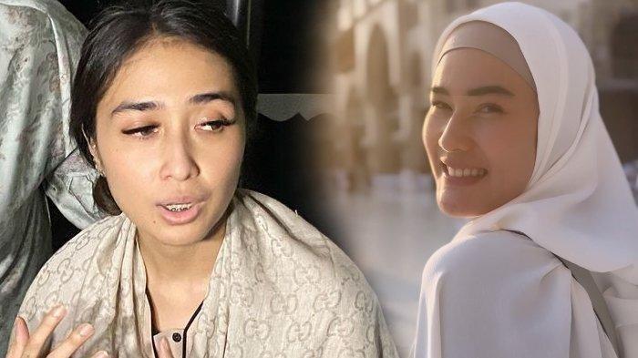 Meninggal dengan Wajah Tersenyum, Kado Terakhir Stevie Agnecya untuk ART Bikin Pilu