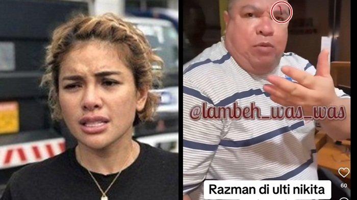 Razman Nasution pasca dipukuli Nikita Mirzani (kanan), Momen Razman Nasution dan Istrinya Dipukuli Nikita Mirzani hingga Berdarah
