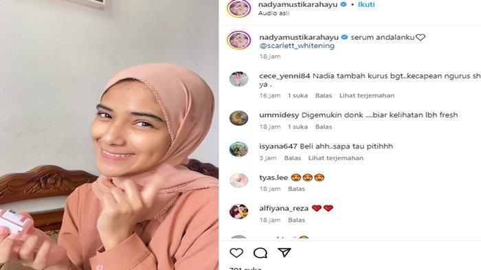 Nadya Mustika disebut terlalu kurus
