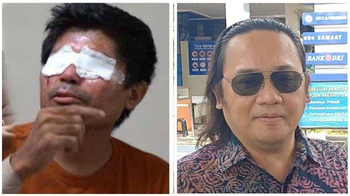Agus Salim, korban penyiraman air keras (kiri) Pengacara Farhat Abbas (kanan) - Nasib pilu donatur Agus Salim, Sabila harus kehilangan janin kembarnya usai dilaporkan pengacara Agus Salim, Farhat Abbas.