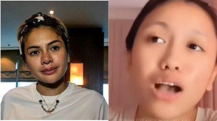 Nikita Mirzani Bongkar Penderitaan Musuhan dengan Lolly