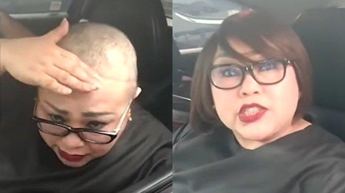 Momen Nunung (kiri) menunjukkan rambut barunya yang muali tumbuh usai menjalani operasi kanker payudara.