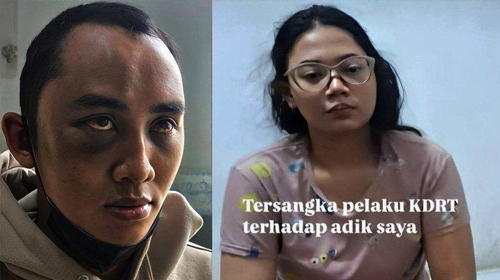 Pegawai ASN Ditonjok Istri hingga Lebam, Sempat tak Ngaku di-KDRT, Disuruh Jalan Kaki 5 KM ke Kantor - Kasus dugaan KDRT dan menghilangnya ASN ini pun viral di media sosial usai sang kakak membagikan kisahnya melalui akun Instagram @asityaarthaz, Minggu (19/1/2025). (IG)