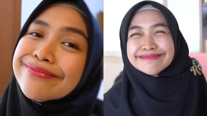 Ngaku Punya Penyakit, Ria Ricis Akan Operasi Hidung, Ingin Bentuknya ...
