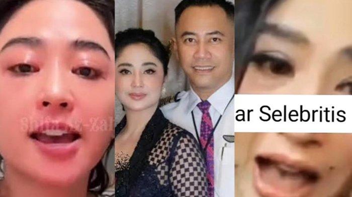 Tidak terima difitnah putus, Dewi Perssik semprot netizen