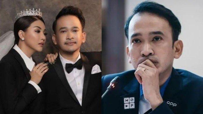 Usai gugat cerai Sarwendah, Ruben Onsu kepergok masih kenakan cincin kawin.
