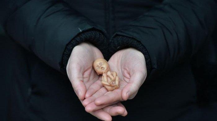 Ilustrasi Aborsi