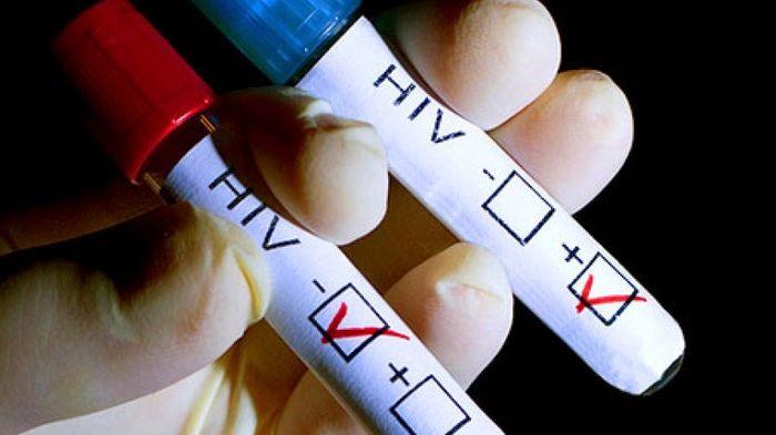 Kasus HIV/AIDS di OKU Timur Sumsel Melonjak, Polisi Siap Tindak Tempat Hiburan Malam dan Hotel Nakal
