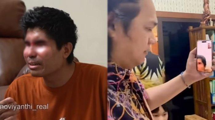 Agus Salim Pria Wajah Disiram Air Keras Sakit Hati dengan Pratiwi Noviyanthi, Curhat Harga Diri Diolok-olok