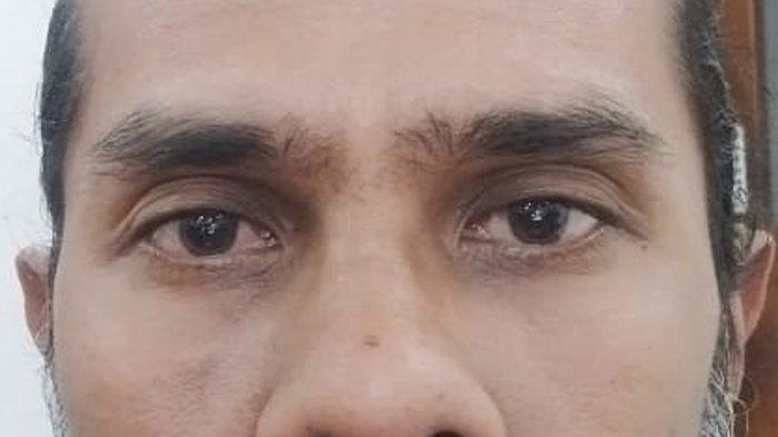 Cara Menghilangkan Mata Panda Cepat dan Alami serta Cara Menghilangkan