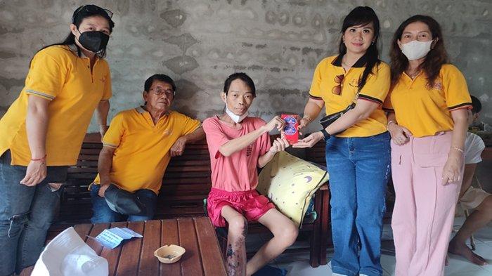 Aling didampingi Tim Baksos Xing Fu menyerahkan bantuan kepada Aliung yang menderita infeksi (borok di kaki) di rumahnya di Jl. Parit Aim 2 No. A23, Sui Ambawang Kuala, Kecamatan Sungai Ambawang, Kabupaten Kubu Raya, Kalbar, Minggu 17 November 2024.