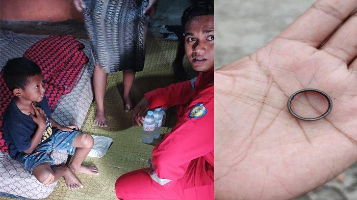 Gambar terkait Anak 9 Tahun Telan Cincin di Indramayu,Ayahnya Panik Telepon Damkar,Keluar dengan Cara Tak Terduga (dari Bing)