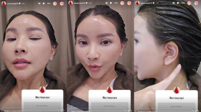 Penampakan wajah baru Sarwendah setelah 10 hari dioperasi plastik. Sarwendah Tan baru saja menjalani operasi plastik di Korea. Kini Sarwendah Tan memamerkan wajah barunya.