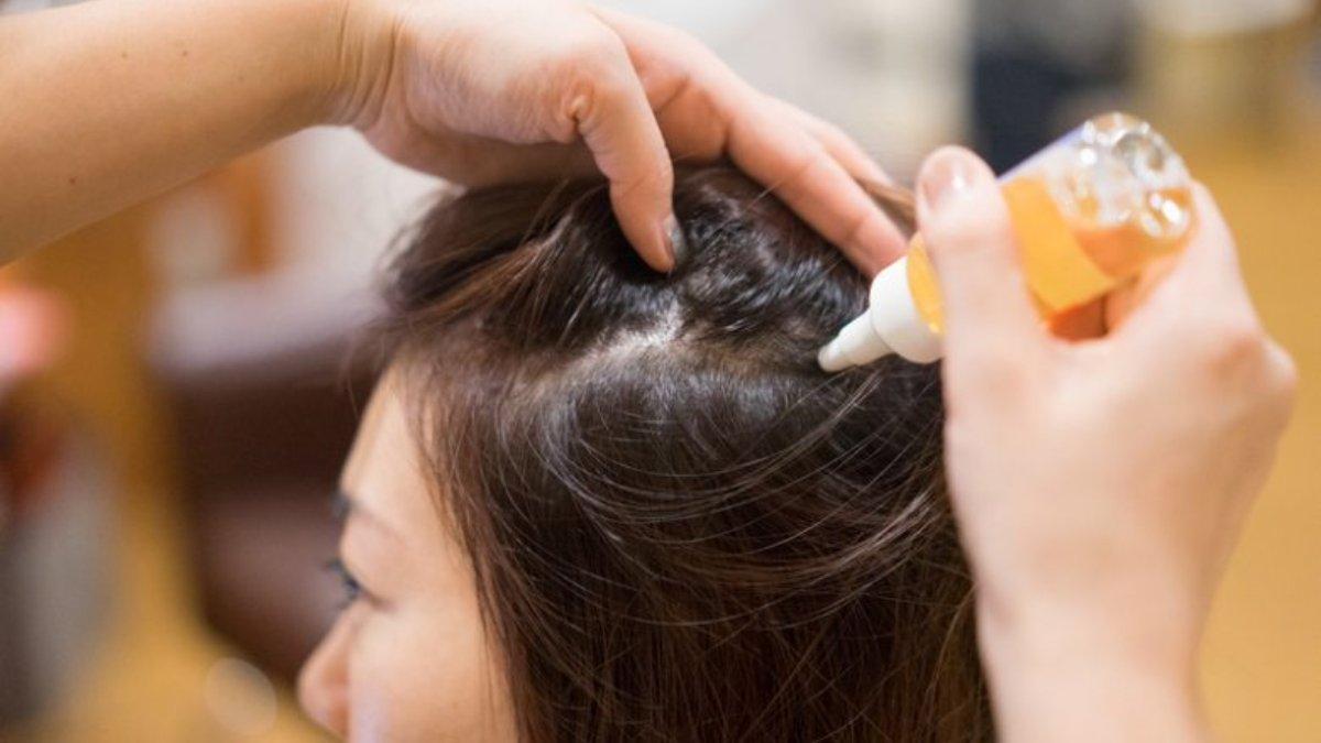 20 Daftar Hair Tonic yang Tidak Bikin Rambut Lepek dan Rontok