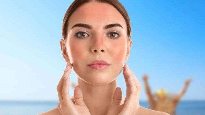 Ilustrasi kulit kemerahan karena sunburn