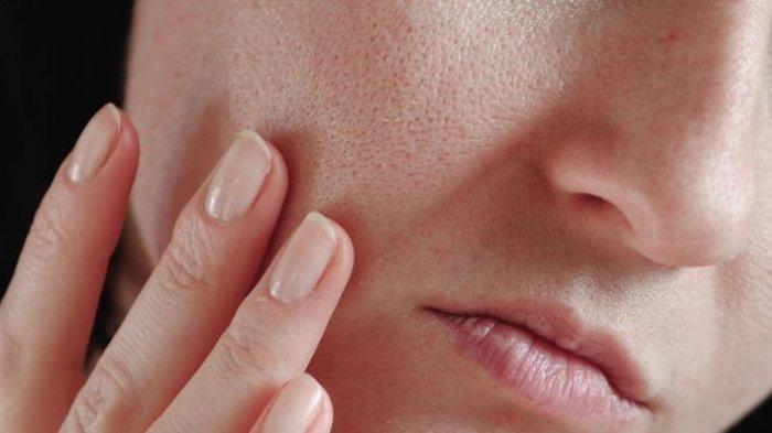 Clay mask bisa membantu mengecilkan pori-pori