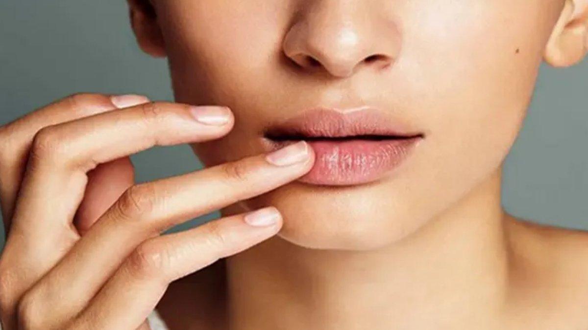 Ilustrasi bibir kering bisa dirawat dengan masker madu.