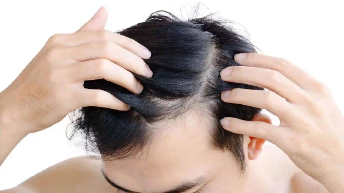 Ilustrasi rambut bebas ketombe.