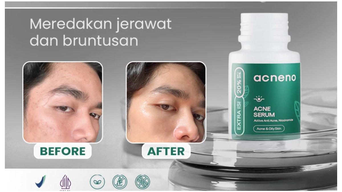 Acneno Serum Wajah Pria